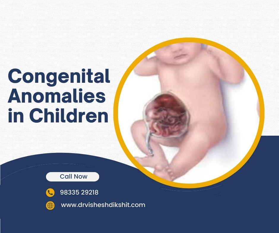 Congenital anomalies in children | Dr. Vishesh Dikshit