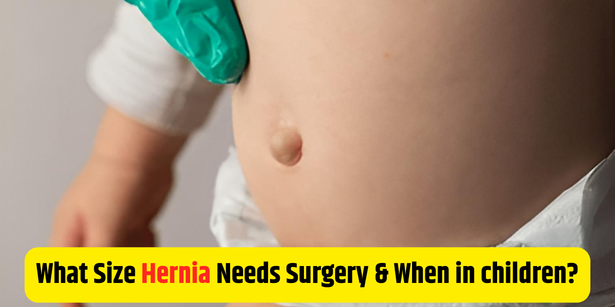 What Size Hernia Needs Surgery & When in children?