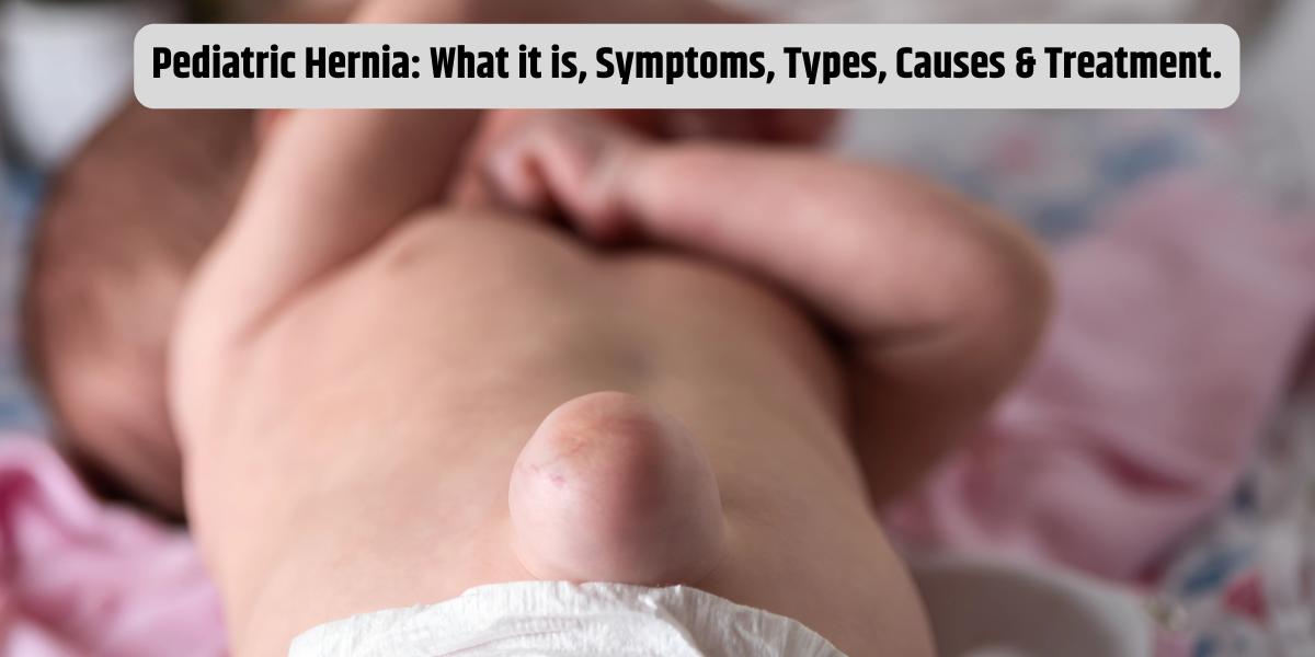 Pediatric Hernia: What it is, Symptoms, Types, Causes & Treatment.